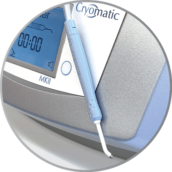 Cryomatic MKII